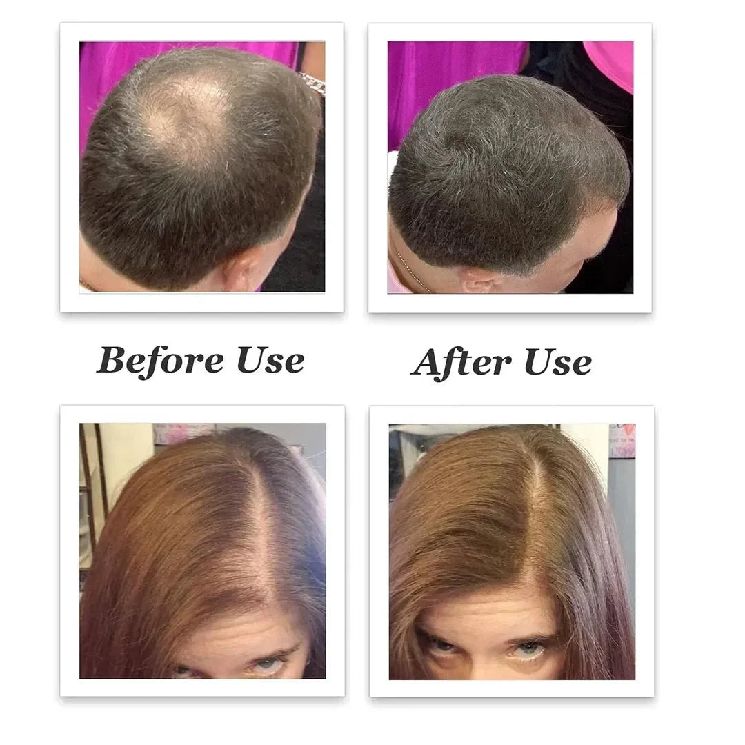 Hair-thickening fibers – an effect of instant thickness
