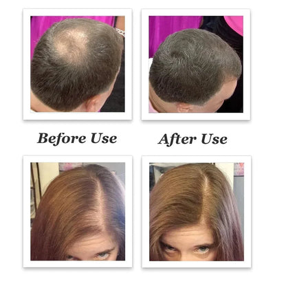 Hair-thickening fibers – an effect of instant thickness